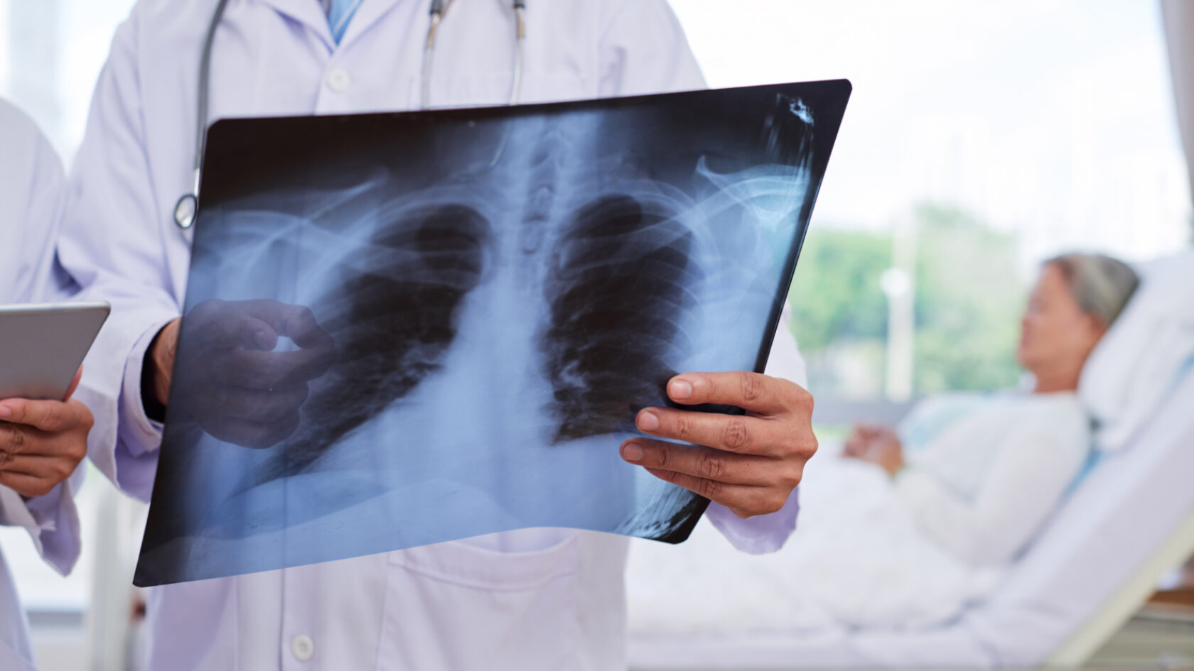 A doctor reviews an X-ray image of a patient's lungs.